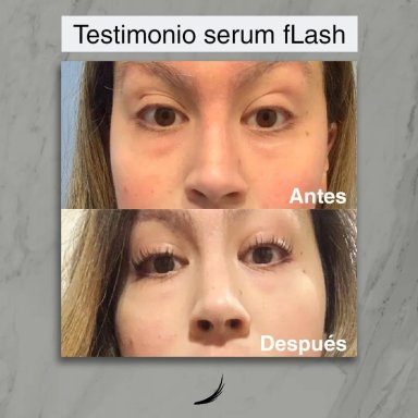 FLASH SERUM PARA CRECIMIENTO DE LAS PESTAÑAS 2 ML+ ENCRESPADOR DE PESTAÑAS BETER - 9