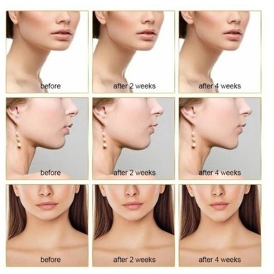 MASAJEADOR INVENCIBLE FACIAL ANTI PAPAD REJUVENECIMIENTO 3EN1 MX64 - 3