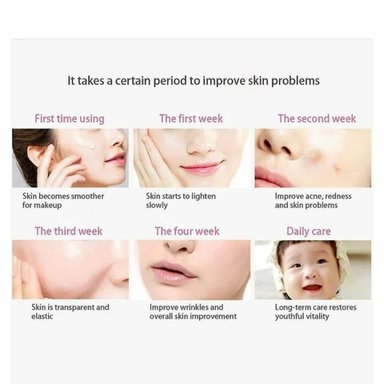 MASAJEADOR INVENCIBLE ANTIPAPADA VIBRACIÓN EMS ADELGAZA FACIAL NB11 - 3