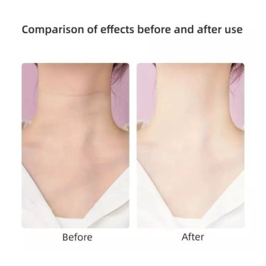 MASAJEADOR CLICK VENTAS REJUVENECEDOR FACIAL CUELLO CON VIBRACIÓN - 4