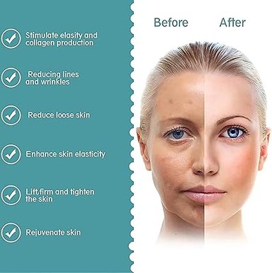 MINI HIFU MÁQUINA DE RADIOFRECUENCIA FACIAL RFLIFTING - 4