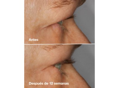 SERUM PESTAÑAS CLINIQUE LASH AMPLIFYING HIGH IMPACT™ 3 ML - 4