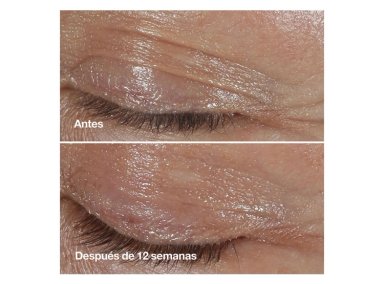 CONTORNO DE OJOS CLINIQUE SMART CLINICAL REPAIR 15 ML - 5