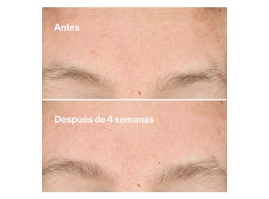 EXFOLIANTE FACIAL CLINIQUE LIMPIADOR CLARIFYING DO OVER PEEL 30 ML - 5
