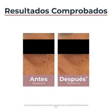 CONTORNO DE OJOS EUCERIN ANTIPIGMENT 15 ML - 8