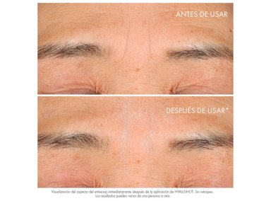 SERUM FACIAL DIOR ANTIARRUGAS CORRECTOR CAPTURE TOTALE HYALUSHOT 15 ML - 2