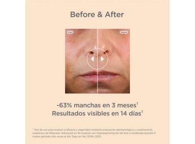 SERUM FACIAL ISDIN ANTIMANCHAS ISDINCEUTICS  CEUTICS MELACLEAR ADVANCED REFILL 30 ML - 8