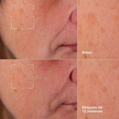 SÉRUM CLINIQUE CLEARING 30 ML - 6