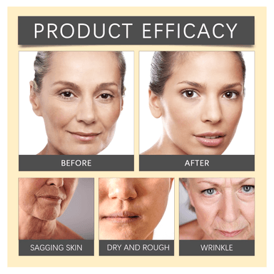 BOTOX BEE VENOM CREMA COLAGENO FACIAL EFECTO LIFTING 20GR - 5