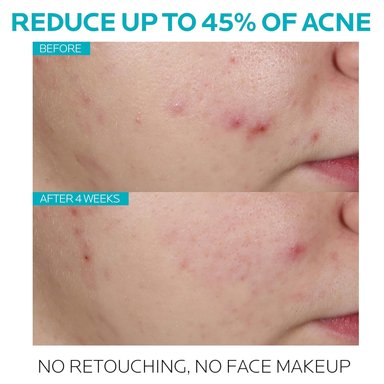 SERUM ANTI IMPERFECCIONES LA ROCHE POSAY EFFACLAR 30ML - 3