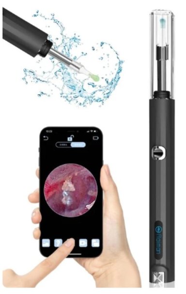 KIT DE LIMPIEZA DE OÍDOS OEM CON CÁMARA OTOSCOPIO 1080P - 2