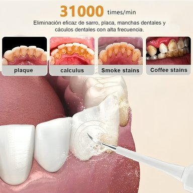 KIT CEPILLO LIMPIADOR DENTAL ELÉCTRICO ULTRASÓNICO REMOVEDOR - 2